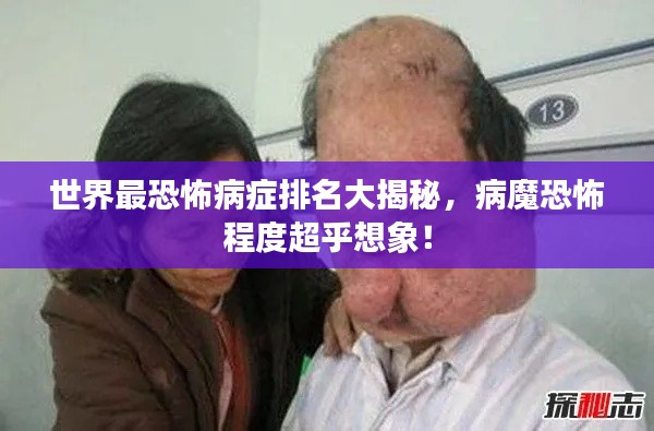 世界最恐怖病症排名大揭秘，病魔恐怖程度超乎想象！