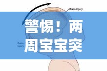 警惕！两周宝宝突发低血糖症状，家长必看！