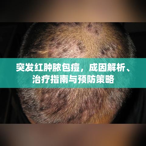 突发红肿脓包痘，成因解析、治疗指南与预防策略